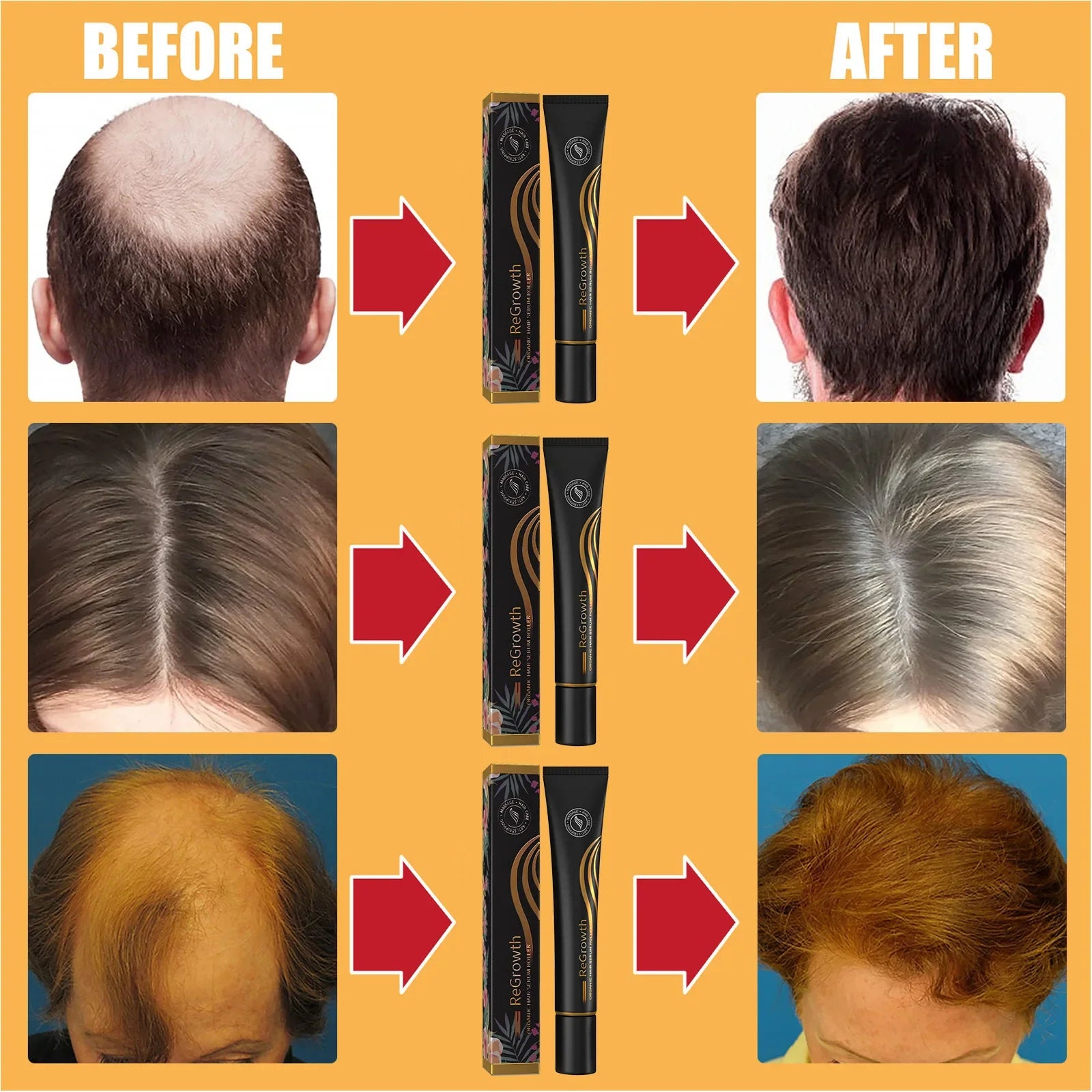 Chebe Hair Growth Shampoo — Ancient African Formula for Fast Hair Loss Treatment
