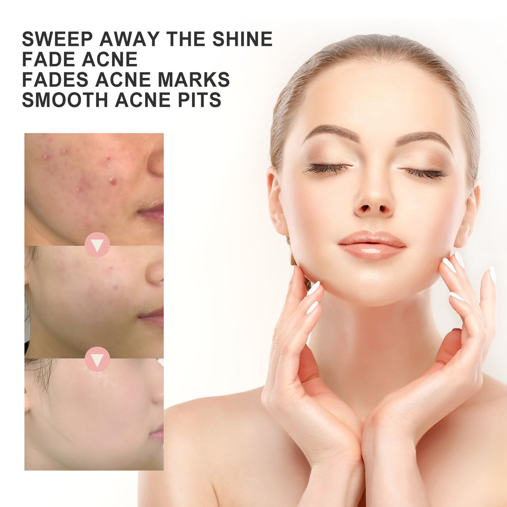 Acne Patch — Pore Cleansing, Blemish Repair & Moisturizing